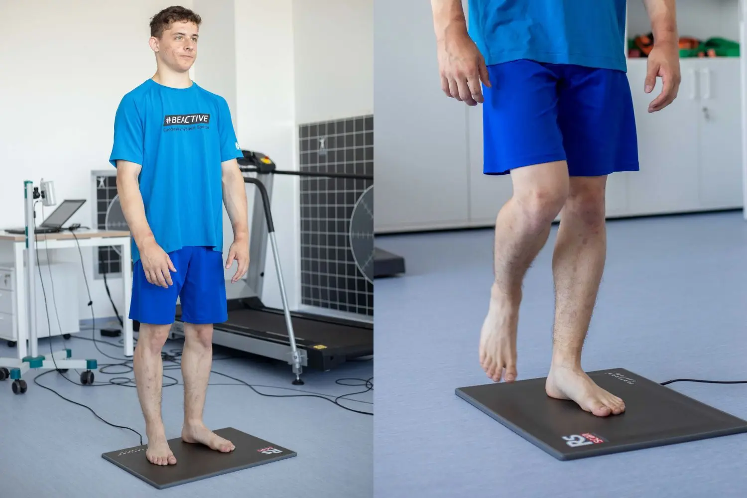 footscan Vyšetrenie chodidla